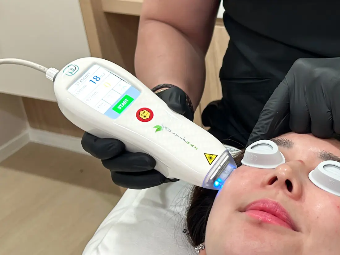 Let us share a refresher on what this treatment is