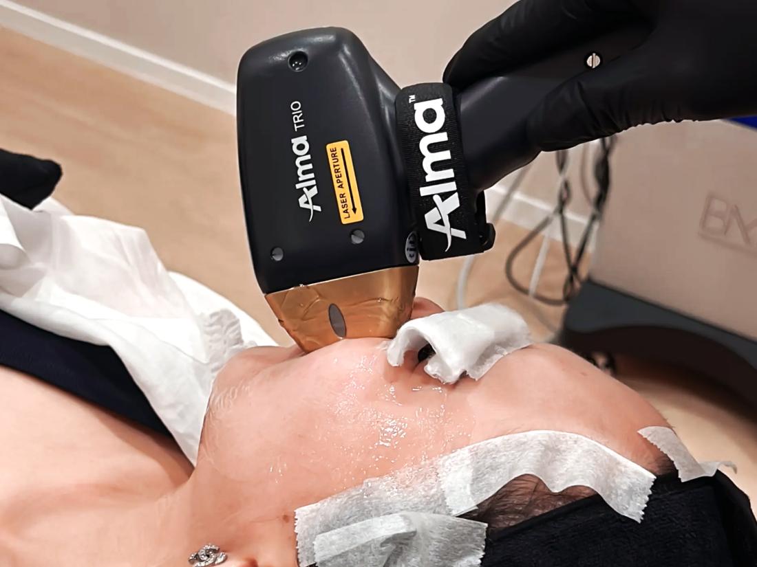 TitaFrax Wins Best All-In-One Anti-Aging Treatment