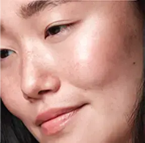 Pigmentation